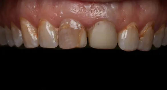 slider3-img