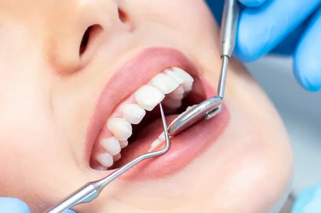 WHY YOU SHOULDN’T SKIP DENTAL CHECK-UPS