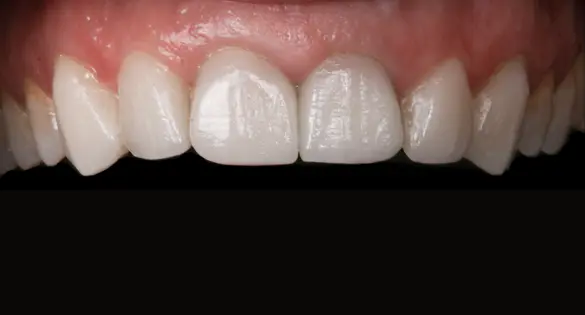 slider6-img