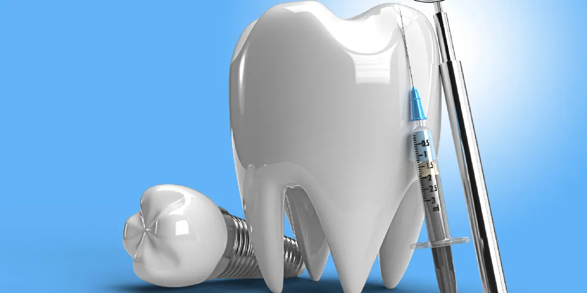 Why do we need Dental Implants? Dental Implants Procedure and Cost